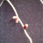 Symbiotic nodules formed by Rhizobium bacteria in the root hairs of Alfalfa plants