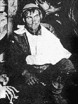 "Thousand Yard Stare"